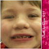 Teeth by Room 211 - Education Photo Book